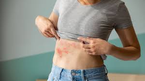 Si tienes mas de 50 años deberías saber esto sobre la Vacuna del Herpes